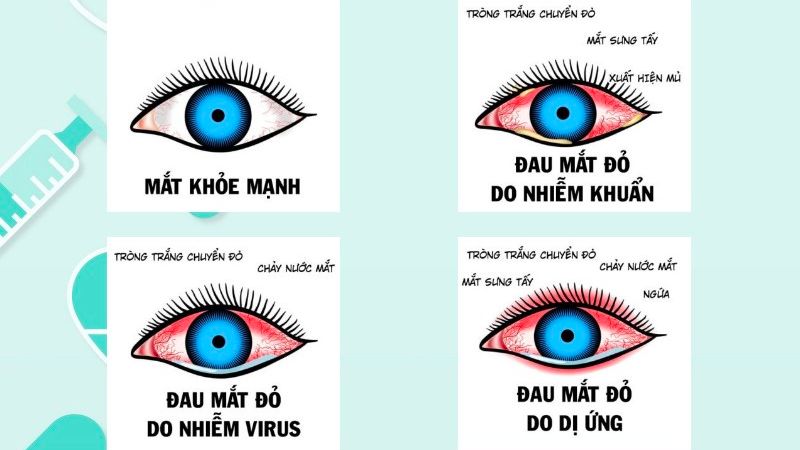 Thông báo của UBND xã Khánh Nhạc về việc triển khai các biện pháp phòng, chống dịch bệnh đau mắt đỏ